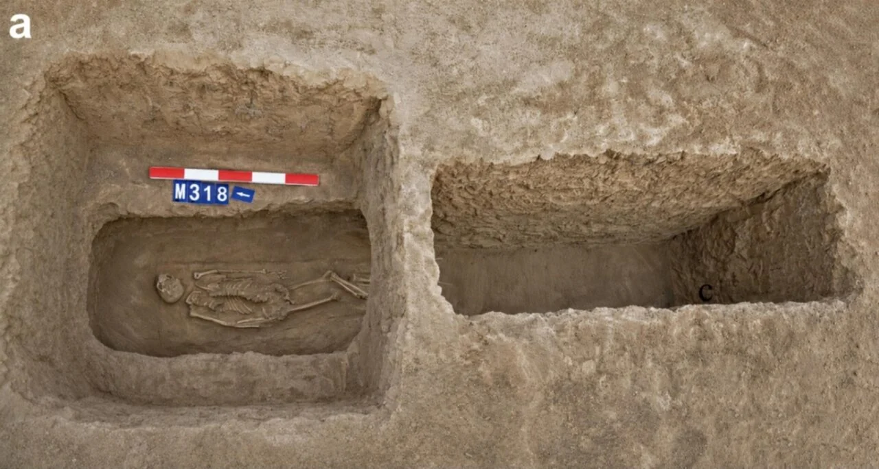 Tomb Nasal Amputation